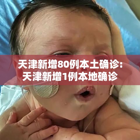 天津新增80例本土确诊:天津新增1例本地确诊 天津新增80例本土确诊:天津新增1例本地确诊