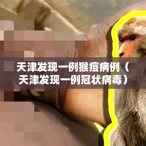 天津发现一例猴痘病例(天津发现一例冠状病毒) 天津发现一例猴痘病例(天津发现一例冠状病毒)