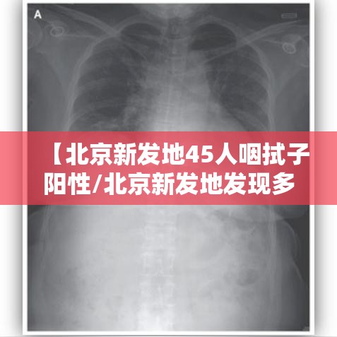 【北京新发地45人咽拭子阳性/北京新发地发现多少病例】 【北京新发地45人咽拭子阳性/北京新发地发现多少病例】