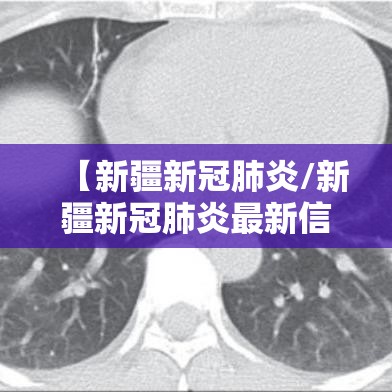 【新疆新冠肺炎/新疆新冠肺炎最新信息】 【新疆新冠肺炎/新疆新冠肺炎最新信息】