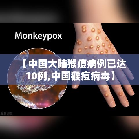 【中国大陆猴痘病例已达10例,中国猴痘病毒】 【中国大陆猴痘病例已达10例,中国猴痘病毒】