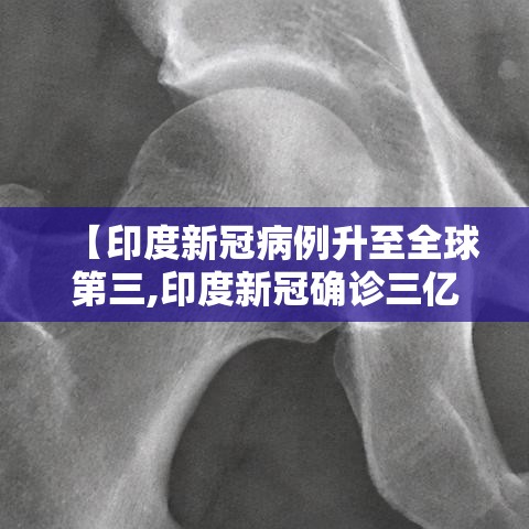 【印度新冠病例升至全球第三,印度新冠确诊三亿】 【印度新冠病例升至全球第三,印度新冠确诊三亿】