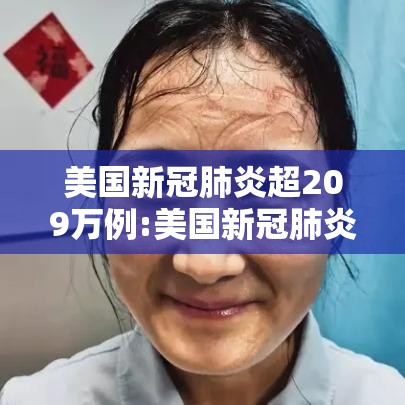 美国新冠肺炎超209万例:美国新冠肺炎超2716万例 美国新冠肺炎超209万例:美国新冠肺炎超2716万例