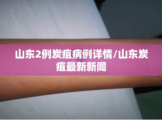 山东2例炭疽病例详情/山东炭疽最新新闻 山东2例炭疽病例详情/山东炭疽最新新闻