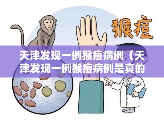 天津发现一例猴痘病例(天津发现一例猴痘病例是真的吗) 天津发现一例猴痘病例(天津发现一例猴痘病例是真的吗)