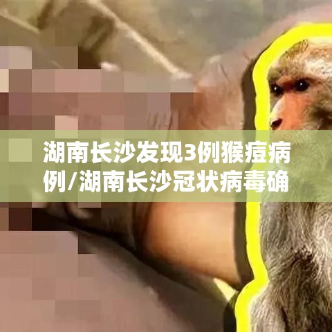 湖南长沙发现3例猴痘病例/湖南长沙冠状病毒确诊 湖南长沙发现3例猴痘病例/湖南长沙冠状病毒确诊