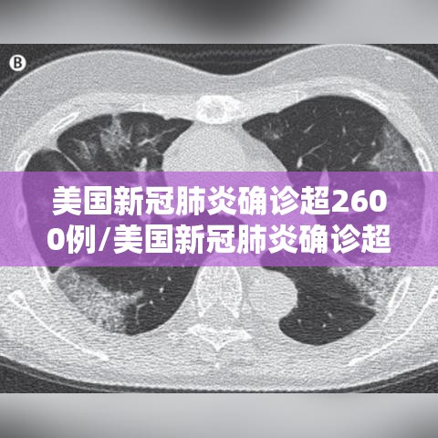 美国新冠肺炎确诊超2600例/美国新冠肺炎确诊超883万