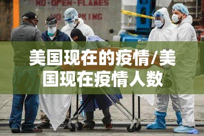 美国现在的疫情/美国现在疫情人数 美国现在的疫情/美国现在疫情人数