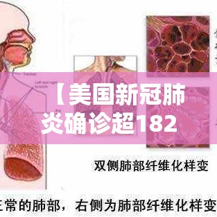 【美国新冠肺炎确诊超182万,美国新冠肺炎确诊超507万例】 【美国新冠肺炎确诊超182万,美国新冠肺炎确诊超507万例】