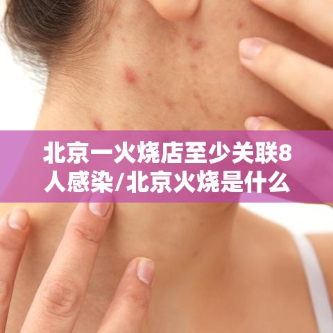 北京一火烧店至少关联8人感染/北京火烧是什么东西 北京一火烧店至少关联8人感染/北京火烧是什么东西