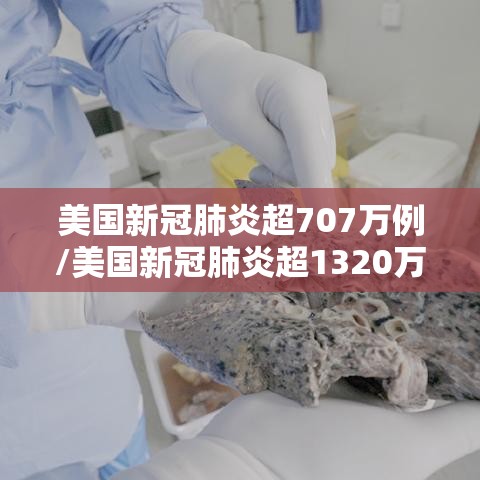 美国新冠肺炎超707万例/美国新冠肺炎超1320万例 美国新冠肺炎超707万例/美国新冠肺炎超1320万例