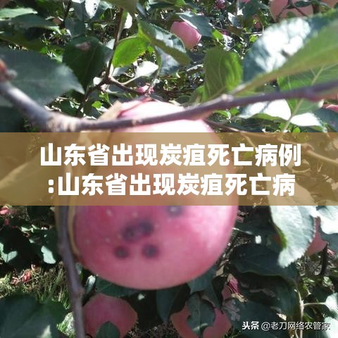 山东省出现炭疽死亡病例:山东省出现炭疽死亡病例多少 山东省出现炭疽死亡病例:山东省出现炭疽死亡病例多少
